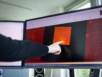 Eine Hand zeigt auf einen leuchtenden Punkt in einer farbigen rot-orangenen Mess- oder Bilddarstellung auf einem Computerbildschirm, flankiert von weiteren Monitoren.