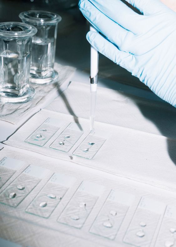 Pipette tropft durchsichtige Flüssigkeit auf kleine durchsichtige Platten.