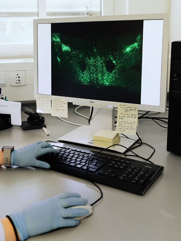 Auf einem Bildschirm werden die grün-fluoreszierenden Punkte des Mäusegehirns sichtbar.