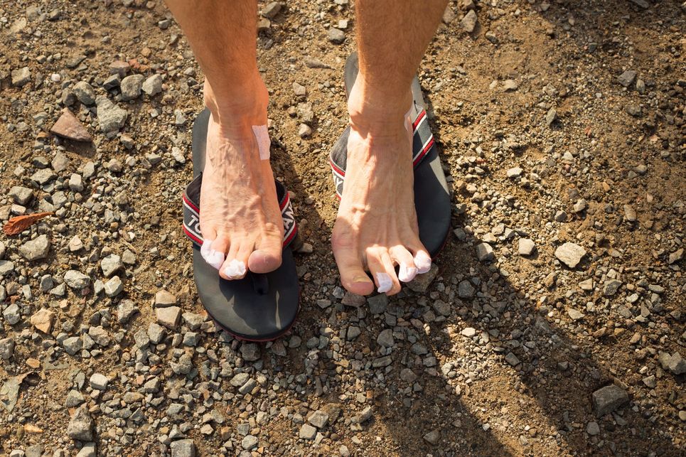 Nackte Füße mit vielen Pflastern an den Zehen auf Flipflops, die auf steinigem Untergrund stehen.